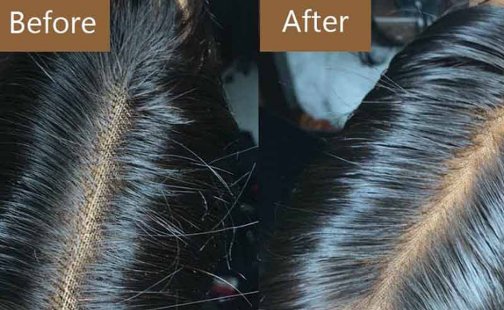 How To Bleach Knots On A Human Hair Wig?