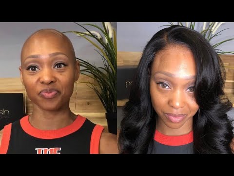 Can I Wear A Human Hair Wig If I Have Alopecia?